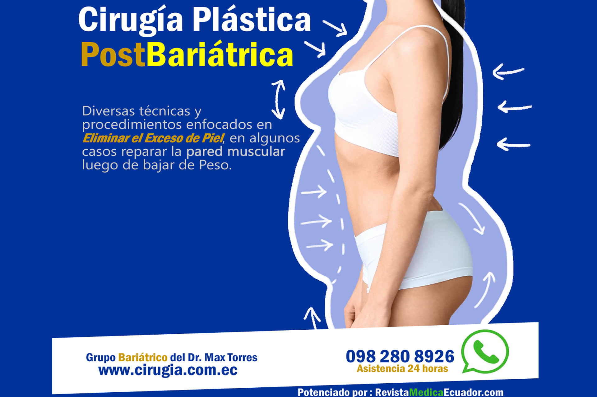 CIRUGIA POST BARIATRICA EN ECUADOR